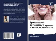 Buchcover von Гигиеническое обслуживание полноростовых протезов с опорой на имплантаты