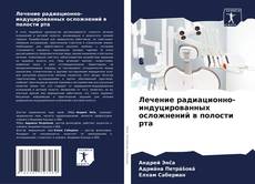 Buchcover von Лечение радиационно-индуцированных осложнений в полости рта