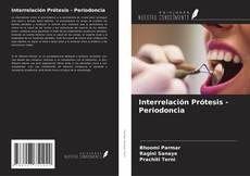 Interrelación Prótesis - Periodoncia的封面