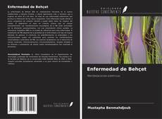 Copertina di Enfermedad de Behçet