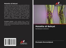 Bookcover of Malattia di Behçet