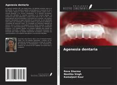 Couverture de Agenesia dentaria