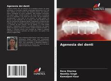 Agenesia dei denti kitap kapağı