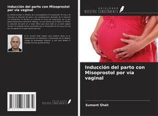 Buchcover von Inducción del parto con Misoprostol por vía vaginal