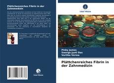 Couverture de Plättchenreiches Fibrin in der Zahnmedizin