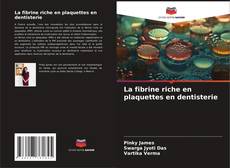 La fibrine riche en plaquettes en dentisterie kitap kapağı