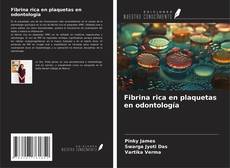 Обложка Fibrina rica en plaquetas en odontología