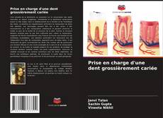 Prise en charge d'une dent grossièrement cariée kitap kapağı