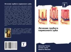 Capa do livro de Лечение грубого кариозного зуба 