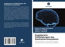 Couverture de Angeborene Fehlbildungen des Zentralnervensystems