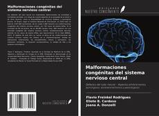 Malformaciones congénitas del sistema nervioso central kitap kapağı