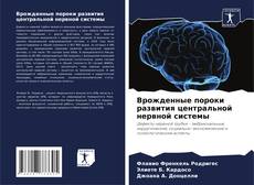 Bookcover of Врожденные пороки развития центральной нервной системы