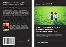 Copertina di Parto eutócico frente a cesárea electiva: resultados en el niño