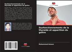 Capa do livro de Dysfonctionnements de la thyroïde et apparition du goitre 