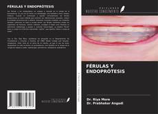 Copertina di FÉRULAS Y ENDOPRÓTESIS