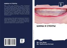 Capa do livro de ШИНЫ И СТЕНТЫ 