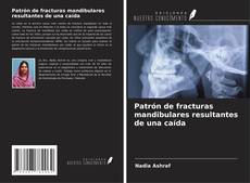 Capa do livro de Patrón de fracturas mandibulares resultantes de una caída 