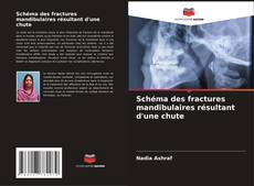 Capa do livro de Schéma des fractures mandibulaires résultant d'une chute 