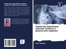 Capa do livro de Характер переломов нижней челюсти в результате падения 