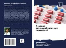 Capa do livro de Лечение везикулобуллезных поражений 