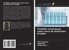 Copertina di Tiroiditis autoinmune como causa de disfunción tiroidea