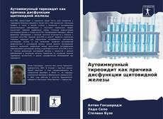 Bookcover of Аутоиммунный тиреоидит как причина дисфункции щитовидной железы