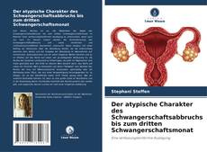 Borítókép a  Der atypische Charakter des Schwangerschaftsabbruchs bis zum dritten Schwangerschaftsmonat - hoz