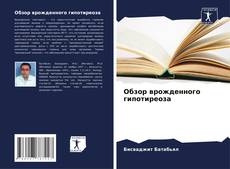 Buchcover von Обзор врожденного гипотиреоза