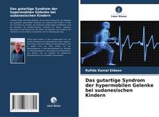 Couverture de Das gutartige Syndrom der hypermobilen Gelenke bei sudanesischen Kindern