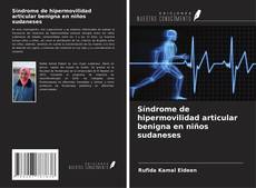 Copertina di Síndrome de hipermovilidad articular benigna en niños sudaneses