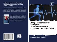 Buchcover von Доброкачественный синдром гипермобильности суставов у детей Судана