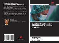 Borítókép a  Surgical treatment of atheromatous carotid stenosis - hoz