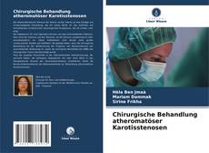 Couverture de Chirurgische Behandlung atheromatöser Karotisstenosen