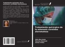 Couverture de Tratamiento quirúrgico de la estenosis carotídea ateromatosa