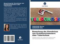 Couverture de Bewertung der Kenntnisse von Krankenschwestern über Tuberkulose