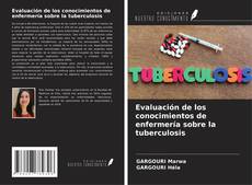 Couverture de Evaluación de los conocimientos de enfermería sobre la tuberculosis