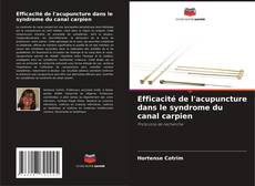 Efficacité de l'acupuncture dans le syndrome du canal carpien kitap kapağı