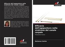 Buchcover von Efficacia dell'agopuntura nella sindrome del canale carpale