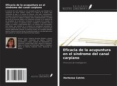 Eficacia de la acupuntura en el síndrome del canal carpiano的封面