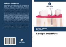 Couverture de Gekippte Implantate