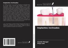 Portada del libro de Implantes inclinados