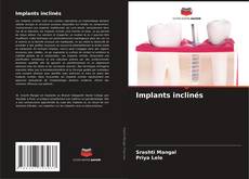 Capa do livro de Implants inclinés 