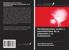 Couverture de Manifestaciones orales y maxilofaciales de la talasemia y su tratamiento