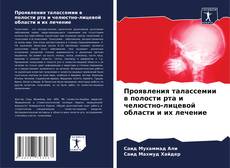 Buchcover von Проявления талассемии в полости рта и челюстно-лицевой области и их лечение