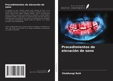 Copertina di Procedimientos de elevación de seno