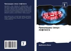 Capa do livro de Процедуры синус-лифтинга 