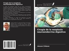Copertina di Cirugía de la neoplasia neuroendocrina digestiva