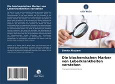 Couverture de Die biochemischen Marker von Leberkrankheiten verstehen