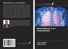 Buchcover von Neumotórax y su tratamiento