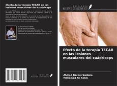 Borítókép a  Efecto de la terapia TECAR en las lesiones musculares del cuádriceps - hoz